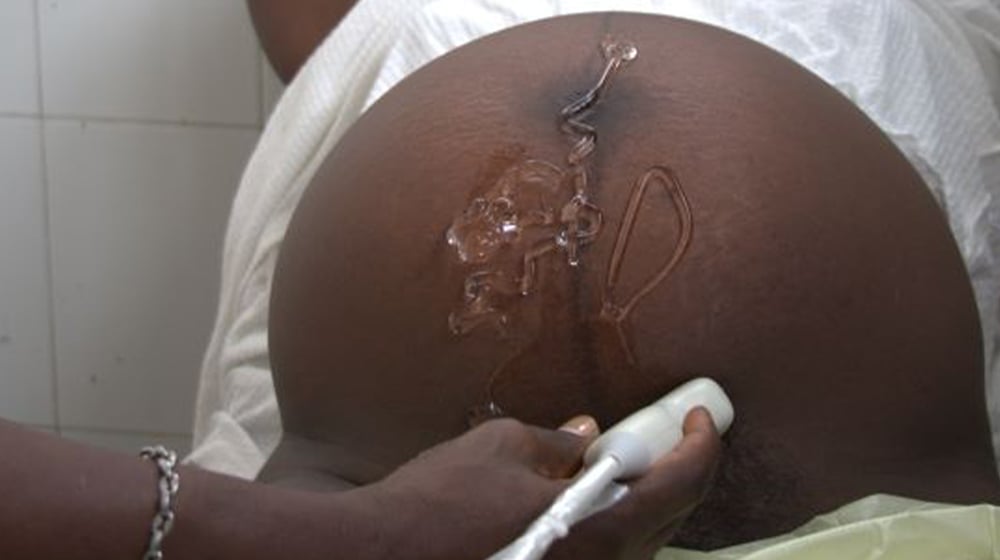 A woman during an ultrasound